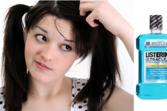 How to Get Rid of Dandruff with LISTERINE!