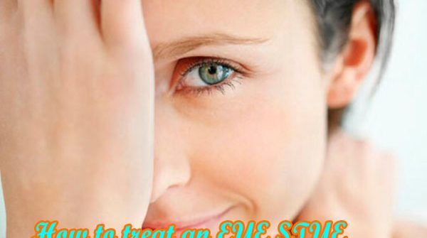 How to treat an EYE STYE!